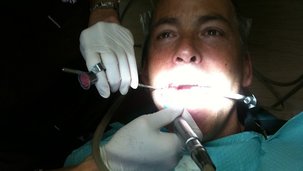 Mann mit geöffnetem Mund und zahnärztlichen Geräten